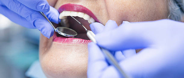 Best Emergency Broken Tooth Repair in Nesconset, NY